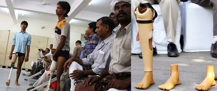 The famous Jaipur Foot makes another victim walk